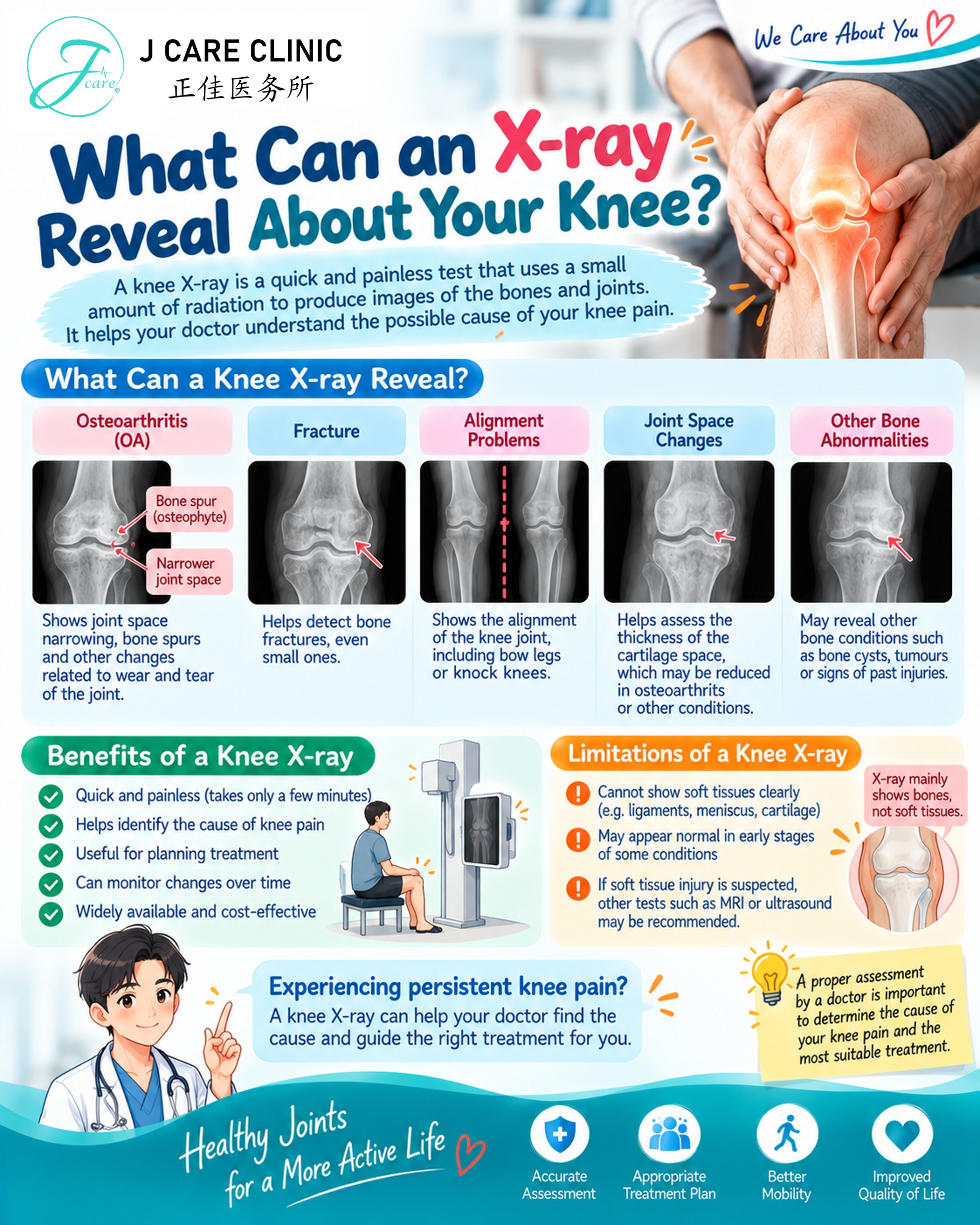 WHAT CAN AN X-RAY REVEAL ABOUT YOUR KNEE?